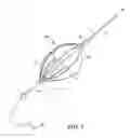 Fig. 05 - Exchange wire anchored by a self-expanding retrievable stent and method of use