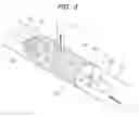 Fig. 04 - INFARCTION PREVENTION DEVICE AND TREATMENT METHOD