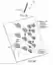 Fig. 11 - Implantable neural modulation device