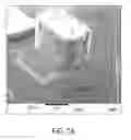 Fig. 12 - Implantable neural modulation device