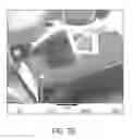 Fig. 13 - Implantable neural modulation device