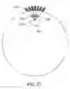 Fig. 32 - Implantable neural modulation device
