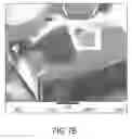 Fig. 13 - Neural modulation system