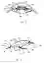 Fig. 03 - REFRACTIVE INTRAOCULAR IMPLANT LENS AND METHOD