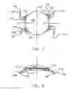 Fig. 05 - REFRACTIVE INTRAOCULAR IMPLANT LENS AND METHOD