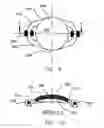 Fig. 06 - REFRACTIVE INTRAOCULAR IMPLANT LENS AND METHOD