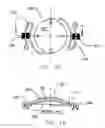 Fig. 09 - REFRACTIVE INTRAOCULAR IMPLANT LENS AND METHOD