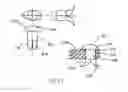 Fig. 11 - REFRACTIVE INTRAOCULAR IMPLANT LENS AND METHOD