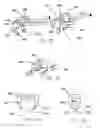 Fig. 14 - REFRACTIVE INTRAOCULAR IMPLANT LENS AND METHOD
