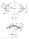 Fig. 17 - REFRACTIVE INTRAOCULAR IMPLANT LENS AND METHOD