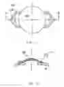 Fig. 19 - REFRACTIVE INTRAOCULAR IMPLANT LENS AND METHOD