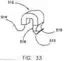 Fig. 20 - REFRACTIVE INTRAOCULAR IMPLANT LENS AND METHOD