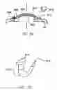 Fig. 21 - REFRACTIVE INTRAOCULAR IMPLANT LENS AND METHOD