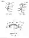 Fig. 23 - REFRACTIVE INTRAOCULAR IMPLANT LENS AND METHOD