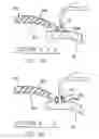 Fig. 24 - REFRACTIVE INTRAOCULAR IMPLANT LENS AND METHOD