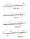 Fig. 05 - Intraocular lens injector