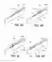 Fig. 06 - Intraocular lens injector