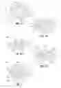 Fig. 04 - ACCOMMODATING INTRAOCULAR LENSES