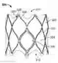 Fig. 01 - Mitral Valve Replacement Toggle Cell Securement