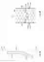 Fig. 05 - Mitral Valve Replacement Toggle Cell Securement