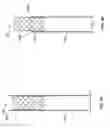 Fig. 06 - Mitral Valve Replacement Toggle Cell Securement