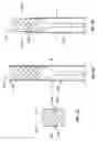 Fig. 09 - Mitral Valve Replacement Toggle Cell Securement