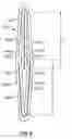 Fig. 14 - Mitral Valve Replacement Toggle Cell Securement