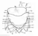 Fig. 01 - Prosthetic valve with improved washout