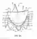 Fig. 06 - Prosthetic valve with improved washout