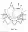 Fig. 10 - Prosthetic valve with improved washout
