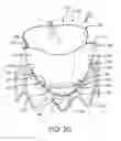 Fig. 12 - Prosthetic valve with improved washout