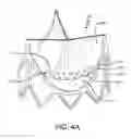 Fig. 14 - Prosthetic valve with improved washout