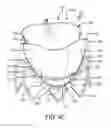 Fig. 16 - Prosthetic valve with improved washout