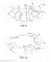 Fig. 23 - Prosthetic valve with improved washout