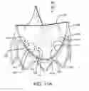 Fig. 24 - Prosthetic valve with improved washout