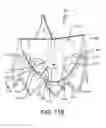 Fig. 25 - Prosthetic valve with improved washout