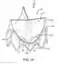 Fig. 30 - Prosthetic valve with improved washout