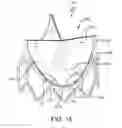 Fig. 31 - Prosthetic valve with improved washout
