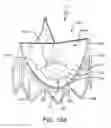 Fig. 32 - Prosthetic valve with improved washout