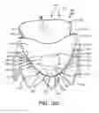 Fig. 34 - Prosthetic valve with improved washout