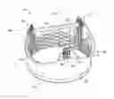 Fig. 01 - Heart valve implant commissure support structure