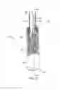 Fig. 03 - Heart valve implant commissure support structure
