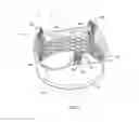 Fig. 04 - Heart valve implant commissure support structure