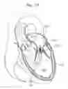Fig. 12 - Dual-flange prosthetic valve frame