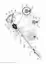 Fig. 02 - Tissue Anchor with Tether Stop