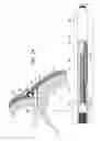 Fig. 03 - Tissue Anchor with Tether Stop