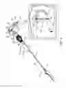 Fig. 07 - Tissue Anchor with Tether Stop