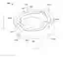 Fig. 01 - Robotic bone preparation for increasing implant contact surface area