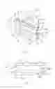 Fig. 02 - Adjustable, Implantable Spinal Disc Device for Deformity Correction in Intervertebral Fusion Procedures