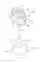Fig. 08 - Adjustable, Implantable Spinal Disc Device for Deformity Correction in Intervertebral Fusion Procedures